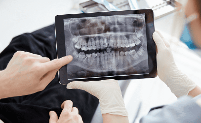 What Can Digital Smile Design Show Before a Smile Makeover Begins_ What-Can-Digital-Smile-Design-Show-Before-a-Smile-Makeover-Begins